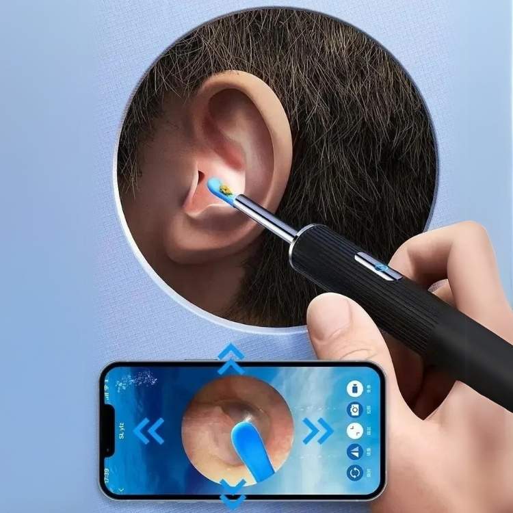 Earwax Removal Kit with Ear Scope and Cleaning Tools