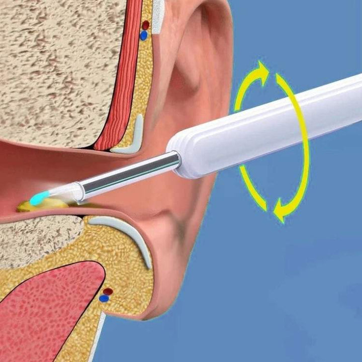 Earwax Removal Kit with Ear Scope and Cleaning Tools